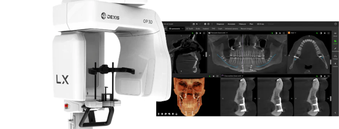 Dental Tech Expert Review: Shining 3D Aoralscan Elite